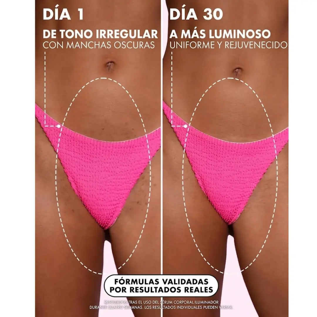 Revelisse Sérum Corporal Iluminador con Vitamina C y Ácido Tranexámico – Para Manchas y Tono Desigual