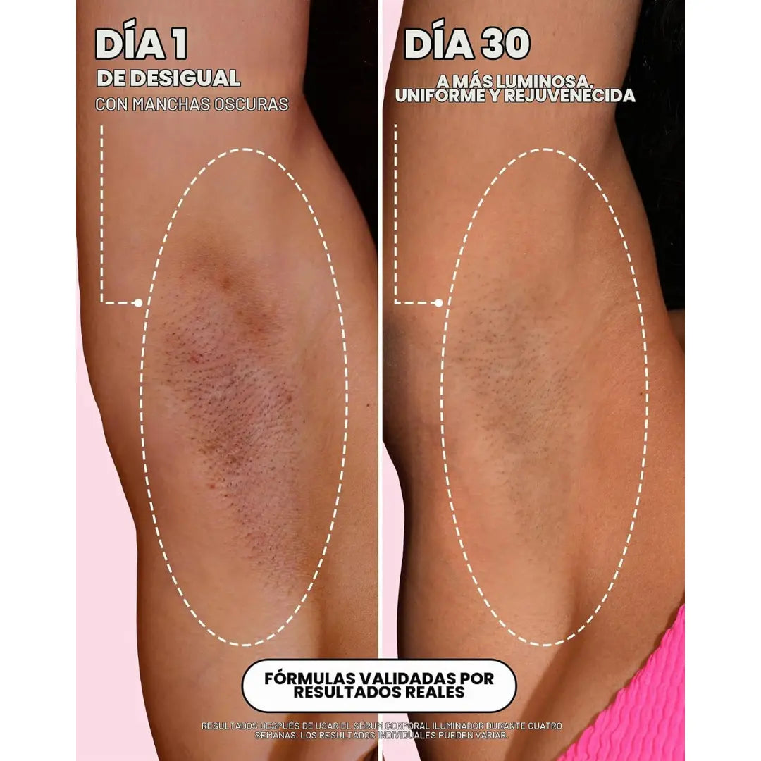 Revelisse Sérum Corporal Iluminador con Vitamina C y Ácido Tranexámico – Para Manchas y Tono Desigual