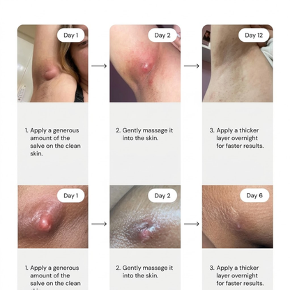 Velisee  Drawing Salve – Natural Beeswax & Propolis Balm for Painful Bumps & Irritated Skin